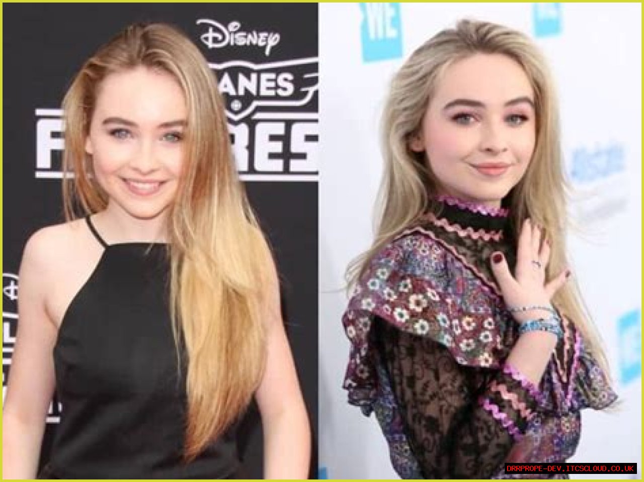 Exploring The Truth: Did Sabrina Carpenter Get A Nose Job?