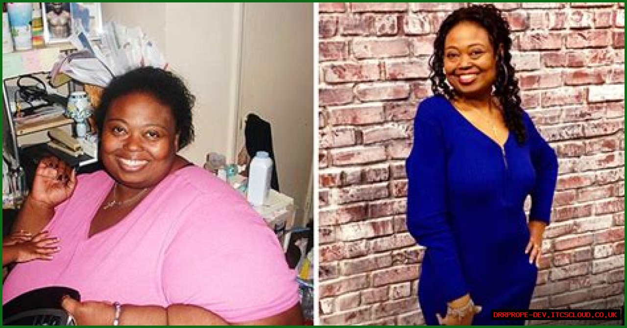 My 600-Lb Life's Marla McCants Has Lost 470 Pounds