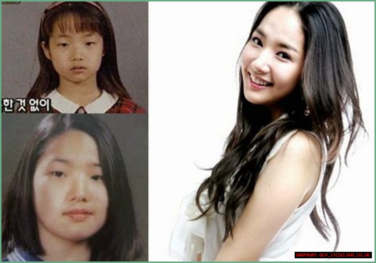Park Min Young's Transformation: Uncovering The Journey Before Surgery