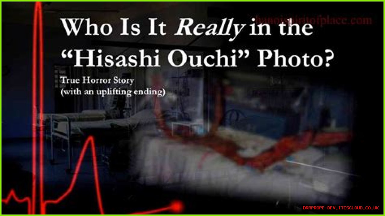 Unraveling The Mystery Of Hisashi Ouchi's Real Body