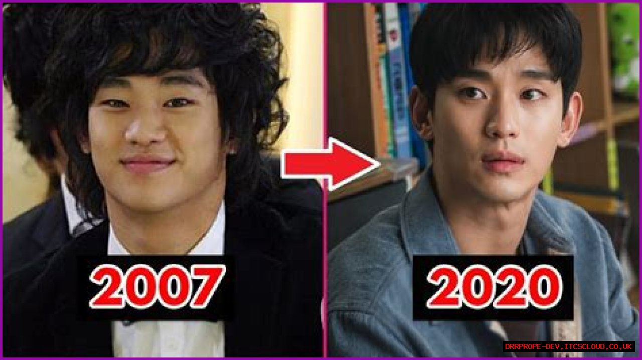 Unveiling The Truth Behind Kim Soo Hyun's Face Surgery
